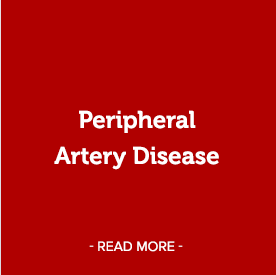 Peripheral Artery Disease